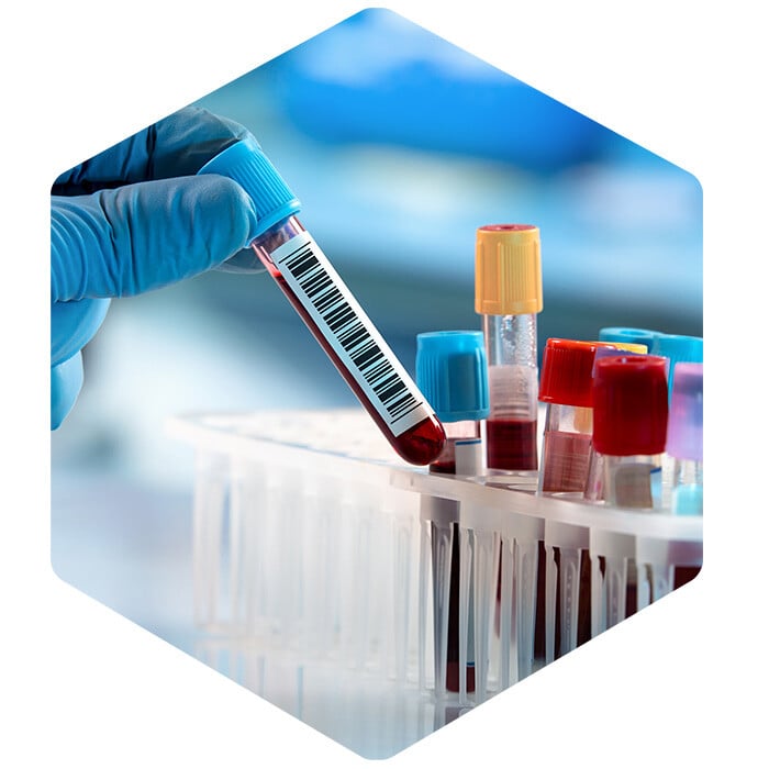Lab Logistics Solutions | Biocair