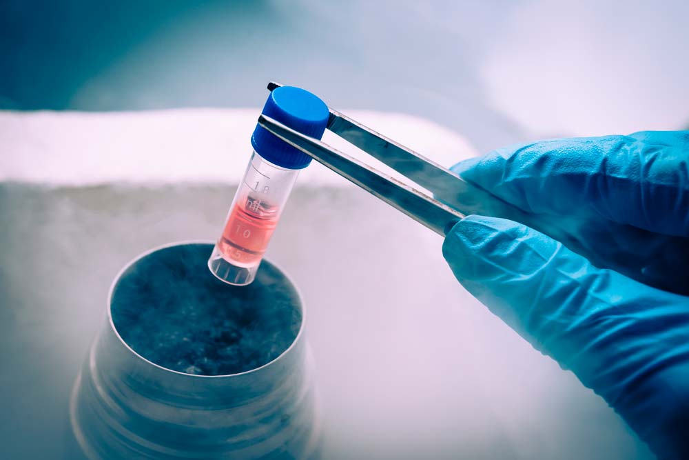 Liquid nitrogen for cell cultures cell samples in liquid nitrogen